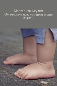 Отечность ног: причины и что делать