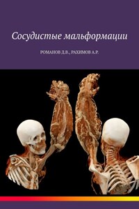 Сосудистые мальформации